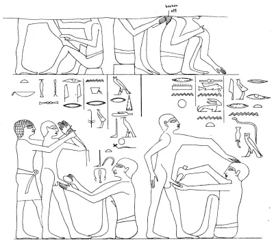 This line drawing is one of the oldest known depictions of surgery in the ancient world. The relief is carved into the doorpost of the tomb 