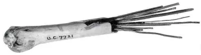 Ancient Egyptian surgical needles